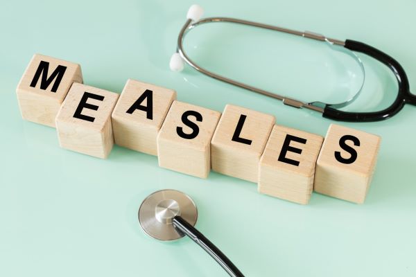 Measles